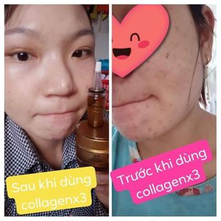 Combo face serum collagen x3