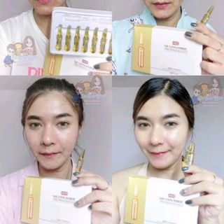 Hộp 7 ống serum