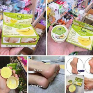 Nứt gót chuối về