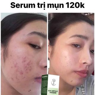 Serum jiuhe