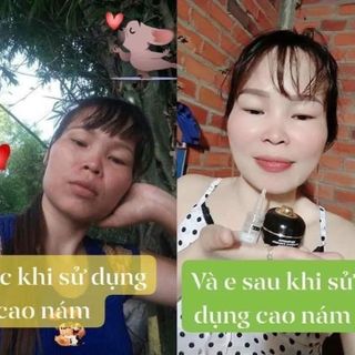 Cao Nám Balaluta giá sỉ