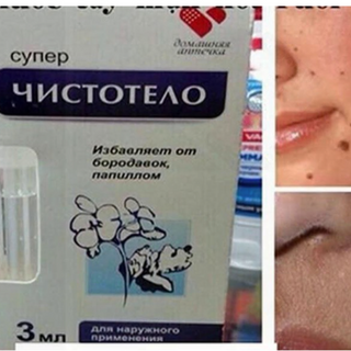 GEL CHẤM TẨY NỐT RUỒI