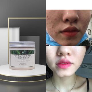 MẶT NẠ THẢO MỘC THANH DƯỢC LÁRE CHO DA MỤN