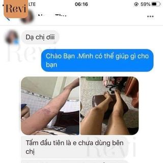 Serum trị thâm phúc minh tâm