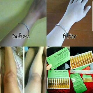 Serum Vitamin C V-C INJECTION