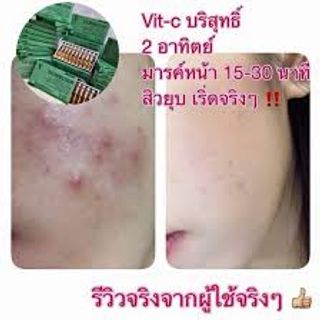 Serum Vitamin C V-C INJECTION