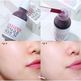 Tinh chất thay da sinh học Red Peel Tingle Serum Sonatural