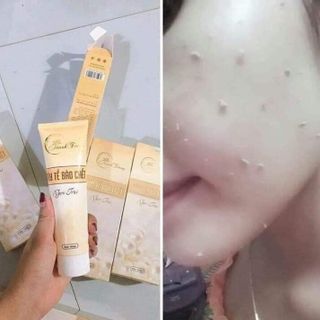 Tẩy Da Chết Thanh Trang