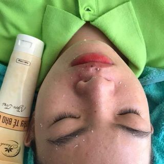 Tẩy Da Chết Thanh Trang