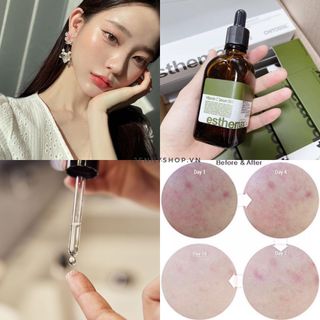 Serum tế bào gốc Vitamin C 561