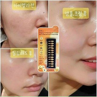 Serum Collagen Tươi
