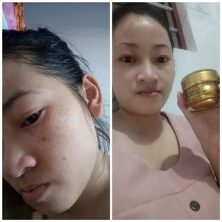 Combo face serum collagen x3 Mỹ phẩm ĐÔNG ANH