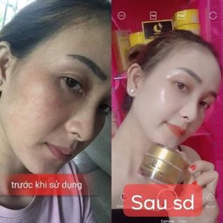 Combo face serum collagen x3 Mỹ phẩm ĐÔNG ANH