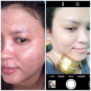 Combo face serum collagen x3 Mỹ phẩm ĐÔNG ANH