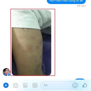 Serum trị thâm đa năng PMT