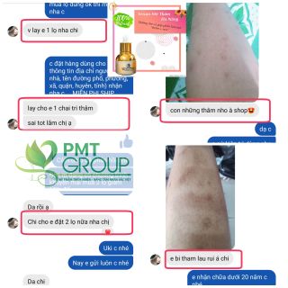 trị thâm đa năng Phúc Minh Tâm