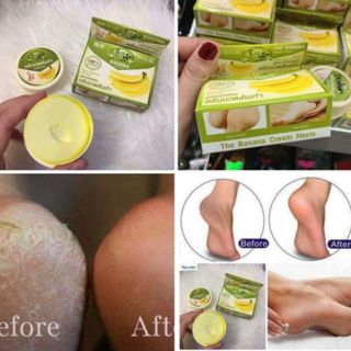 Kem Trị Nứt Gót Chân The Banana Cream Heels