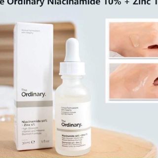 Serum trị thâm mụn Ỏdinary#KT