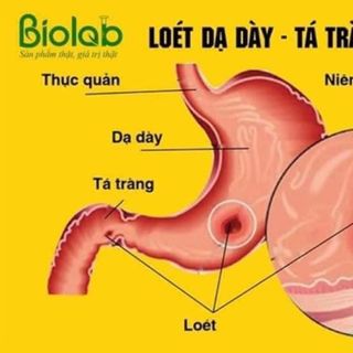 TINH CHẤT BIOQUEEN - Hỗ trợ bổ huyết, Tăng cường sinh lý nữ, Giúp hạn chế lão hoá làm đẹp da