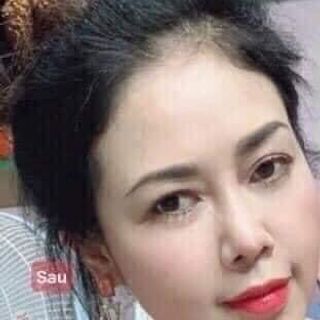 FACE TRỊ NÁM, TÀN NHANG