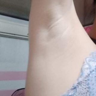 Kem trị thâm nách - hôi nách Bà Thảo