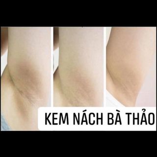 Kem trị thâm nách - hôi nách Bà Thảo