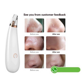 MÁY HÚT MỤN MINI CẦM TAY BLACK HEAD CAO CẤP 3 CHẾ ĐỘ HÚT, SẠCH MỤN CÁM, MỤN ĐẦU ĐEN, LÀM SẠCH LỖ CHÂN LÔNG
