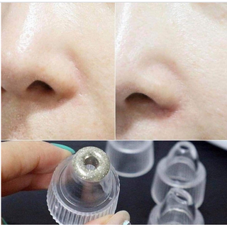 MÁY HÚT MỤN MINI CẦM TAY BLACK HEAD CAO CẤP 3 CHẾ ĐỘ HÚT, SẠCH MỤN CÁM, MỤN ĐẦU ĐEN, LÀM SẠCH LỖ CHÂN LÔNG