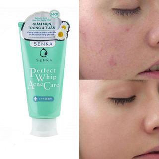 Sữa Rửa Mặt Dành Cho Da Mụn Acnes 100g - Senka