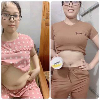 kem tan mỡ cô bông x10 top1