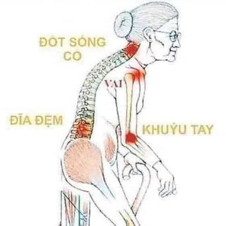 THUỐC TRỊ XƯƠNG KHỚP – GOUT NOXA 20