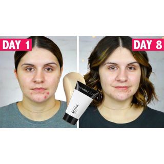 Tinh Chất Chống Lão Hóa THE INKEY LIST Retinol Anti-Aging Serum 30ml