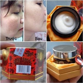 Kem vua khử nám Nhật Bản