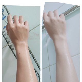 colagen huyết thanh truyền trắng