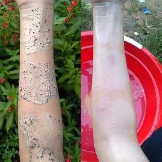 Tắm trắng cà phê