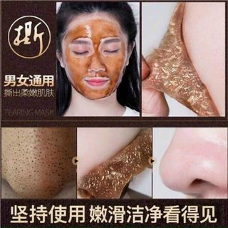 Lột Mụn Đầu Đen