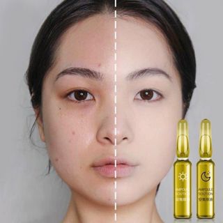 Bộ serum ngày đêm 28 ống