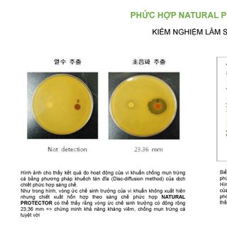 SỮA RỬA MẶT TRẮNG DA CHO DA DẦU, DA MỤN, DA HỖN HỢP GEL CLEANSER