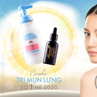 Serum Trị Mụn Hanayuki Acnes