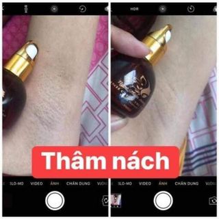 Tinh chất xoá thâm Ngọc Thiên Hương, xoá thâm body,thâm nách,thâm mụn,thâm môi,thâm mắt giúp da trắng tự nhiên(date mới)