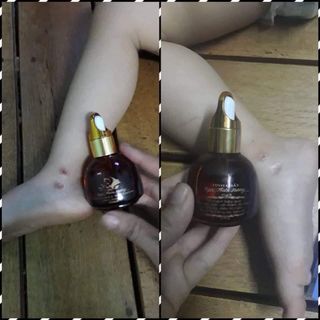 Tinh chất xoá thâm Ngọc Thiên Hương, xoá thâm body,thâm nách,thâm mụn,thâm môi,thâm mắt giúp da trắng tự nhiên(date mới)