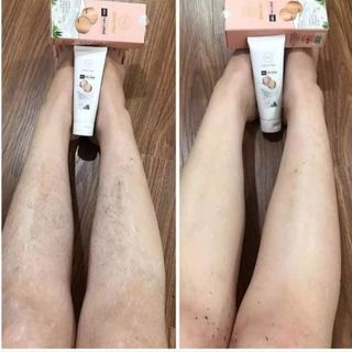 [ ] Combo Triệt Lông Vĩnh Viễn Mamen (Kem Tẩy Lông+serum Triệt Lông Vĩnh Viễn)