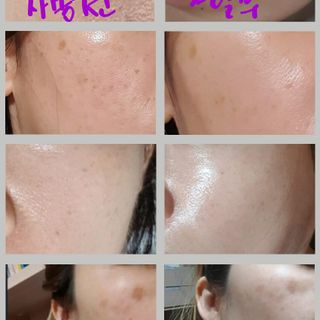 HUYẾT THANH YEONBISOO (THE ONE TREATMENT SERUM)