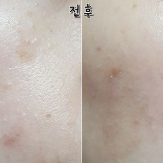 TINH CHẤT YEONBISOO (THE ONE TREATMENT ESSENCE)