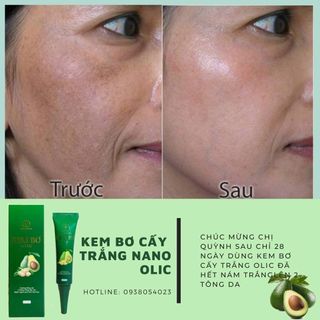 Kem Bơ Dưỡng Da Chống Nắng Ban Ngày