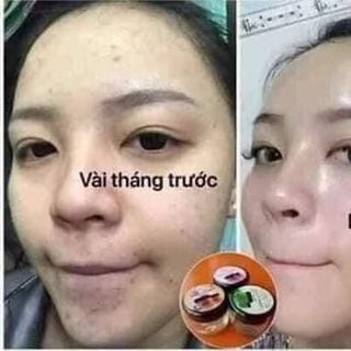 Mask yến tươi collagen