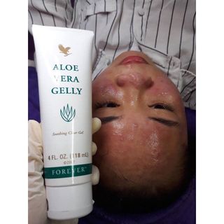 Gel Nha Đam
