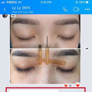 Dưỡng dài mi zzvenus
