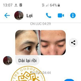 Dưỡng dài mi zzvenus