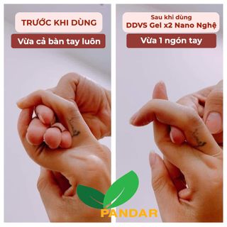 Gel vệ sinh phụ nữ x2 nano nghệ, hết hôi, hết ngứa, sạch thơm, chai 150ml, Cỏ cây hoa lá, PANDAR